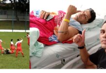 Jogador sofre grave fratura durante semifinal do Municipal de Futebol 7 em Medianeira